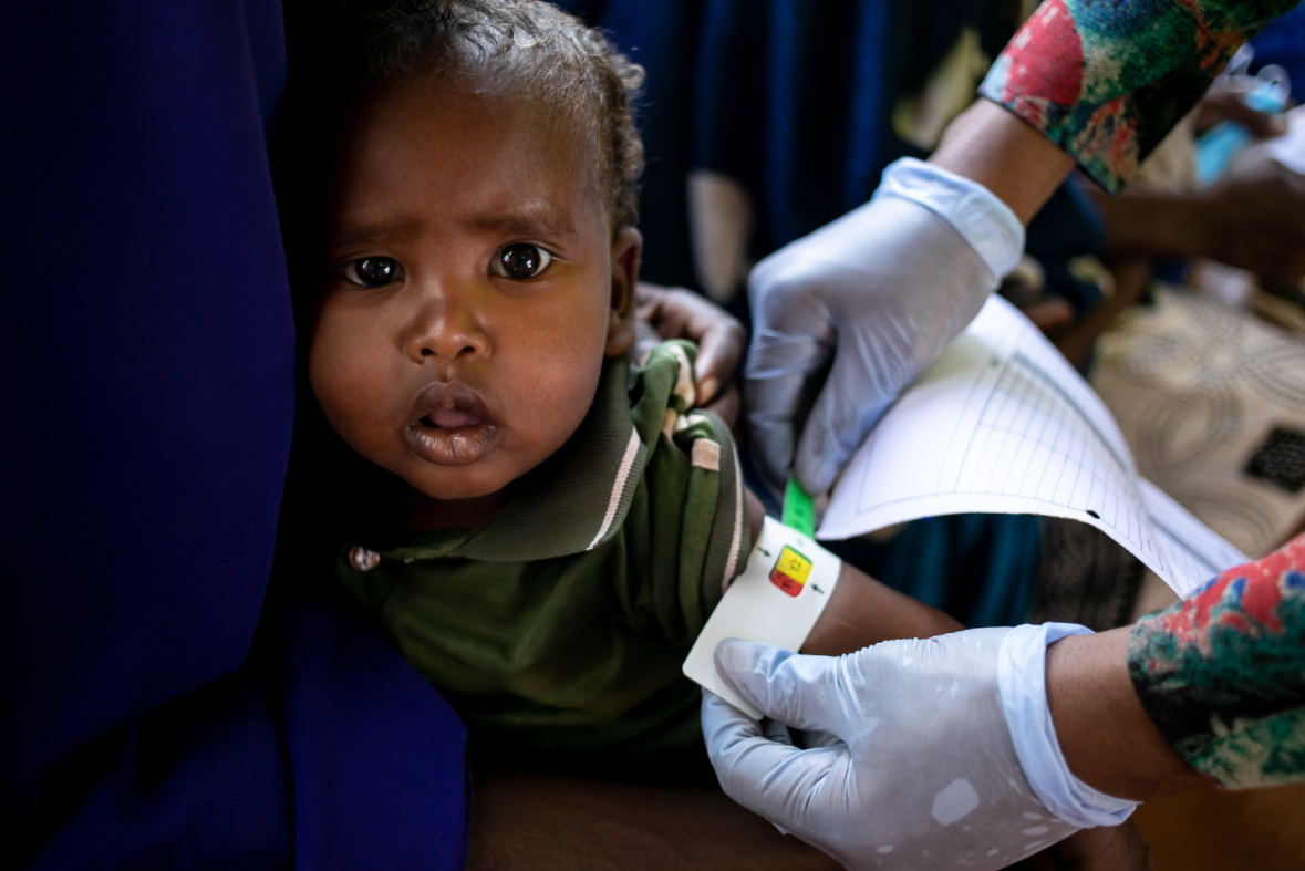 <p><sub>Somalia: A child has its mid-upper arm circumference measured to gauge for evidence of malnutrition, at Dolow Health Centre, on 3 February 2022. UNICEF continues their life-saving assistance through drought-affected areas, working with families, local communities, organizations and governments throughout Somalia.</sub></p>